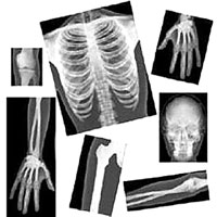 Roylco True to Life Human X-Rays